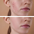 INFORMACJE DERMATOLOGICZNE!